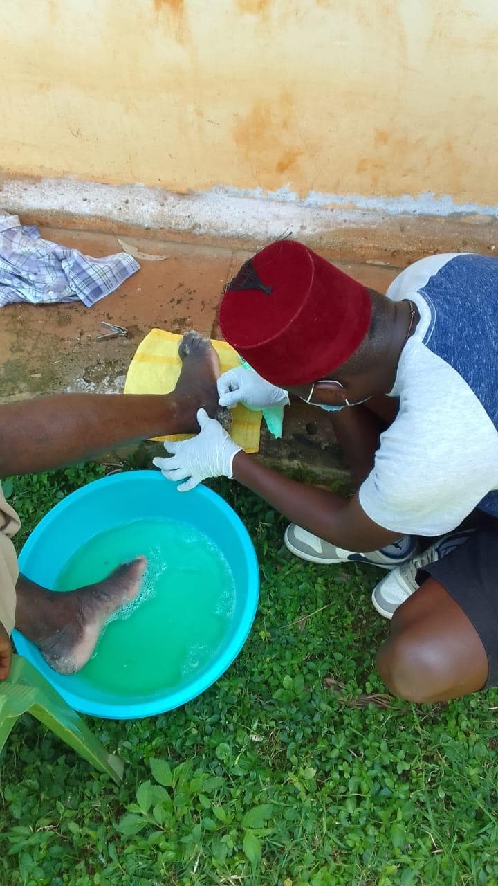 volunteers removing jiggers from a community member's feet during a free outreach medical campaign in Siaya County, Kenya.